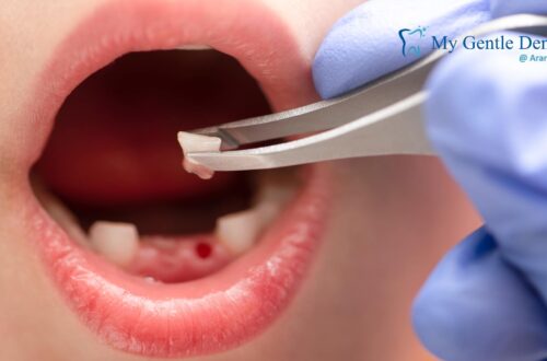 knocked-out tooth