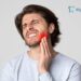 Wisdom Tooth Pain