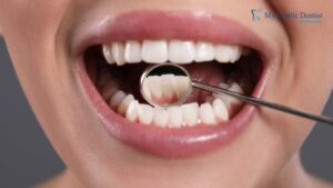 Gum Disease