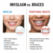 Invisalign vs Braces
